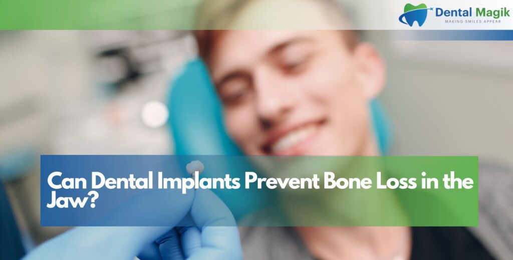 Can Dental Implants Prevent Bone Loss in the Jaw?