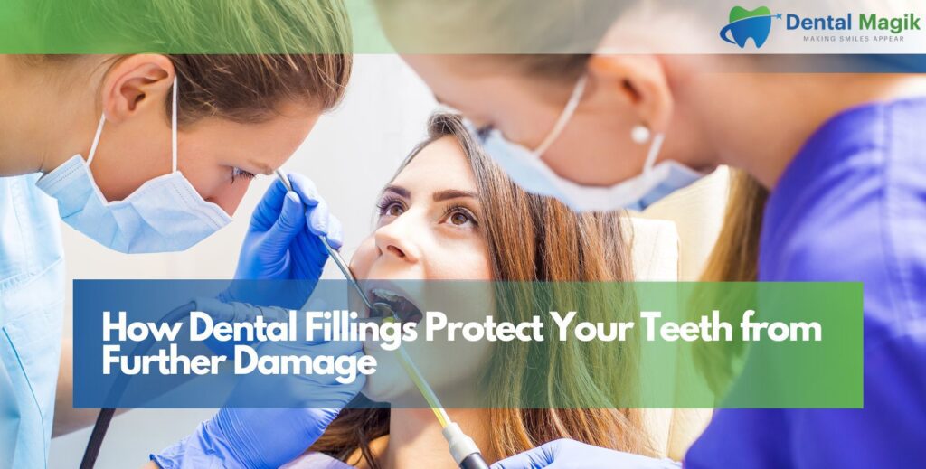 How Dental Fillings Protect Your Teeth from Further Damage