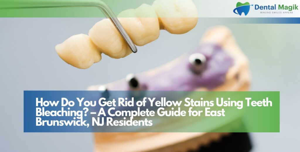 How Do You Get Rid of Yellow Stains Using Teeth Bleaching? – A Complete Guide for East Brunswick, NJ Residents