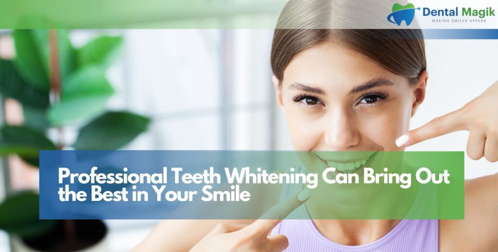 Professional Teeth Whitening Can Bring Out the Best in Your Smile