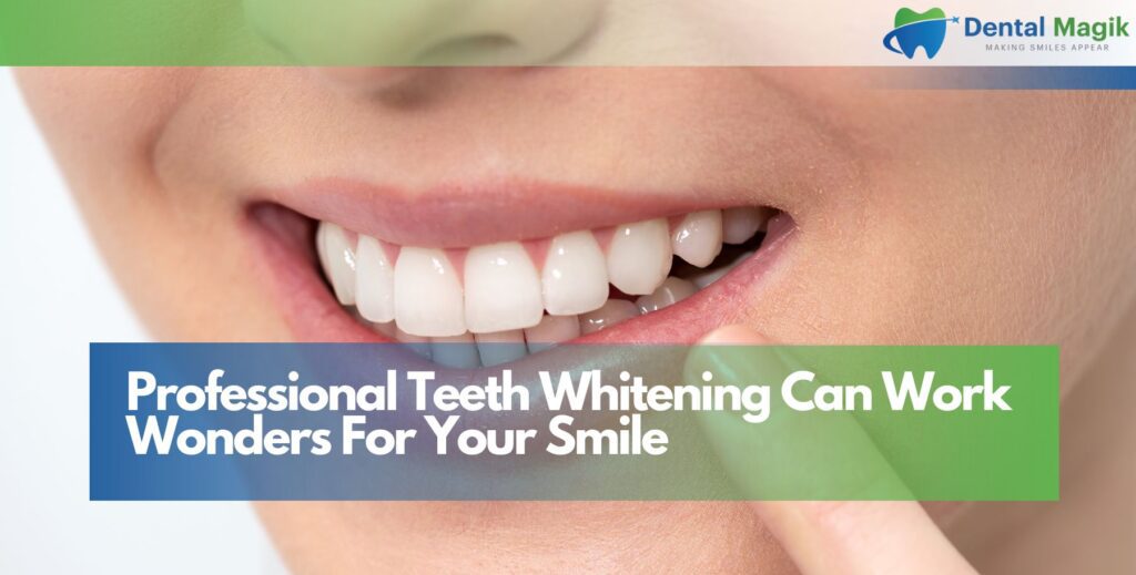 Professional Teeth Whitening Can Work Wonders For Your Smile