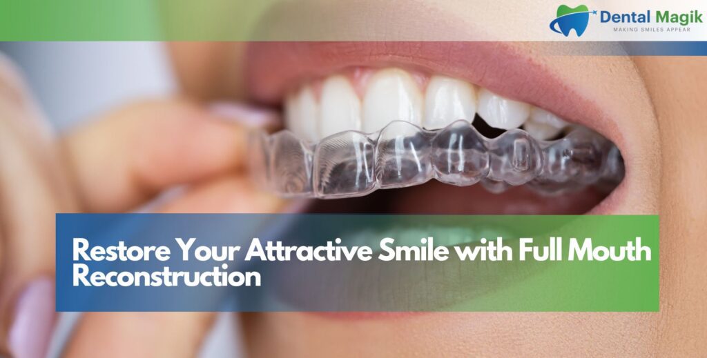Restore Your Attractive Smile with Full Mouth Reconstruction