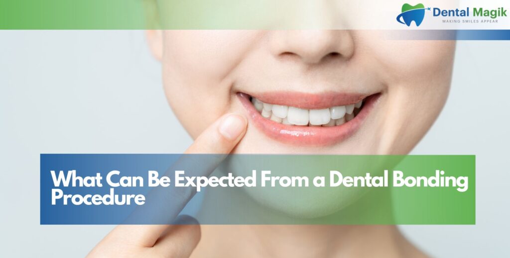 What Can Be Expected From a Dental Bonding Procedure