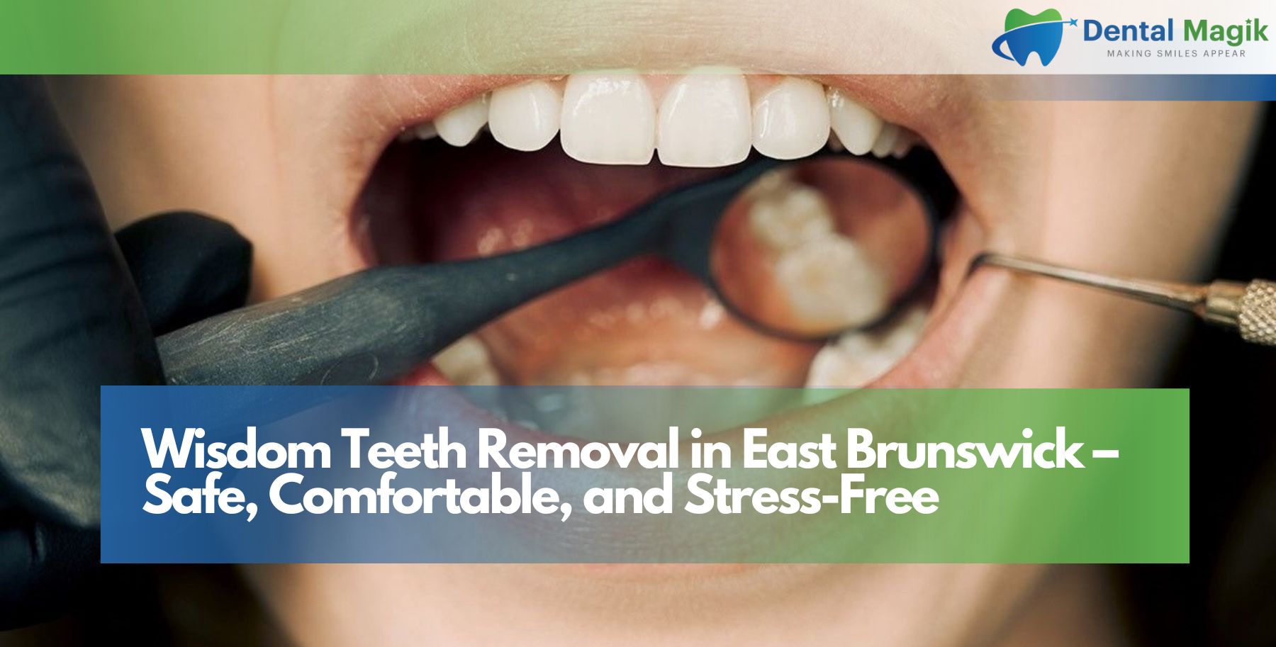 Wisdom Teeth Removal in East Brunswick