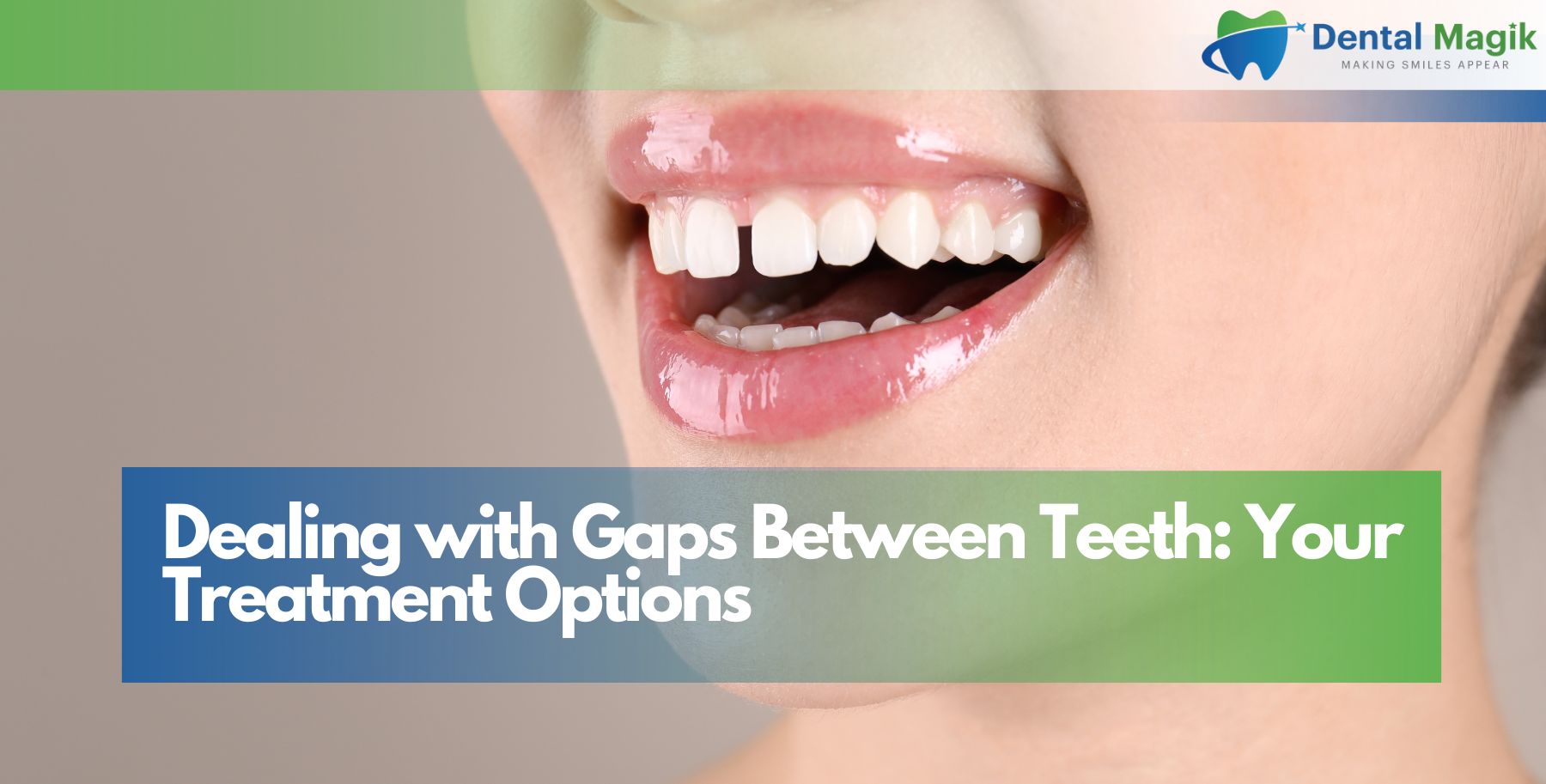 Dealing with Gaps Between Teeth: Your Treatment Options