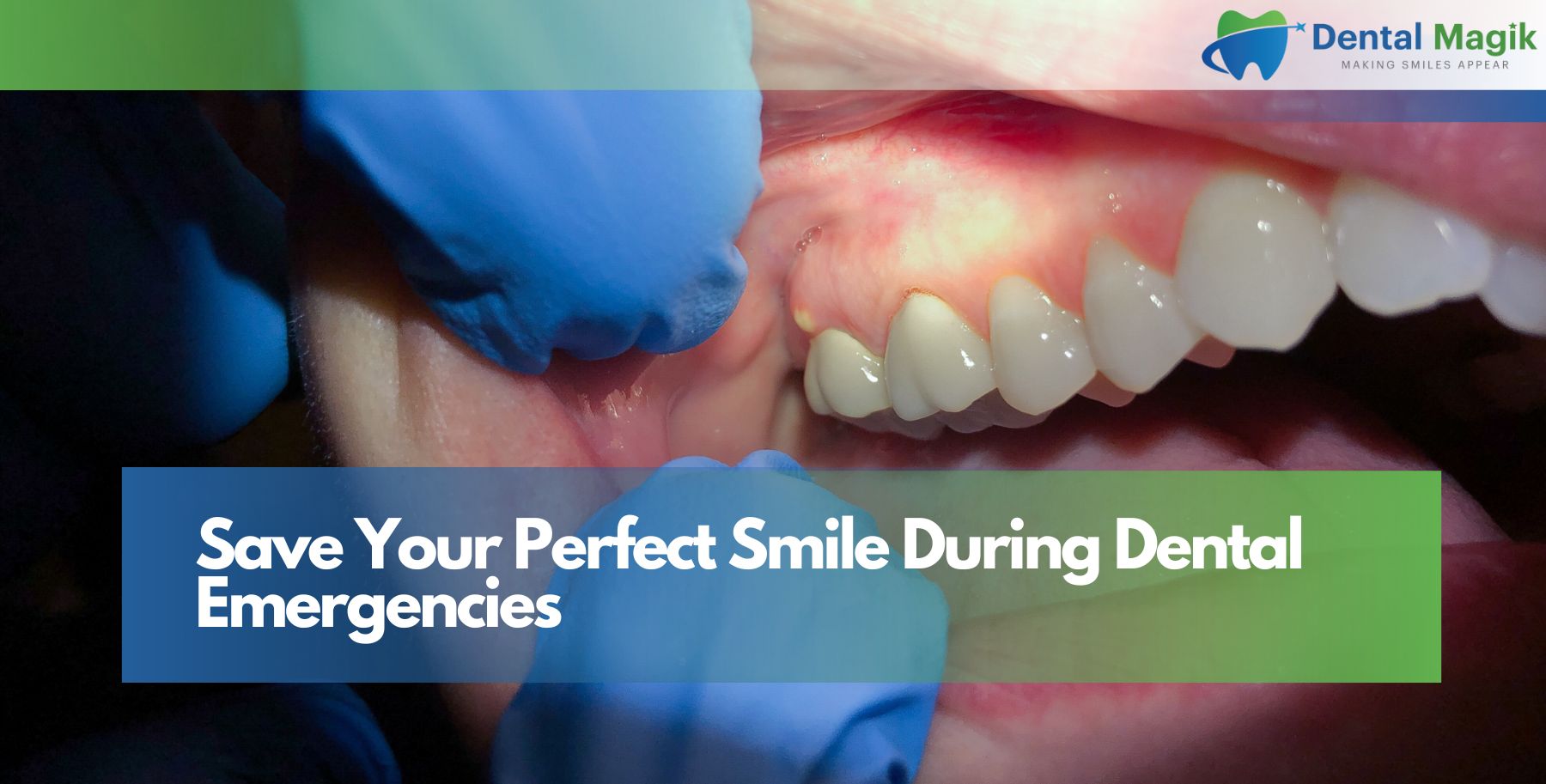Save Your Perfect Smile During Dental Emergencies