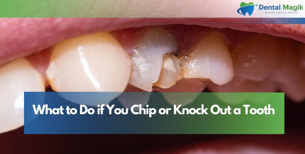 What to Do if You Chip or Knock Out a Tooth