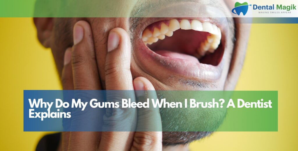Why Do My Gums Bleed When I Brush? A Dentist Explains