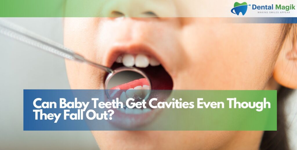 Can Baby Teeth Get Cavities Even Though They Fall Out?