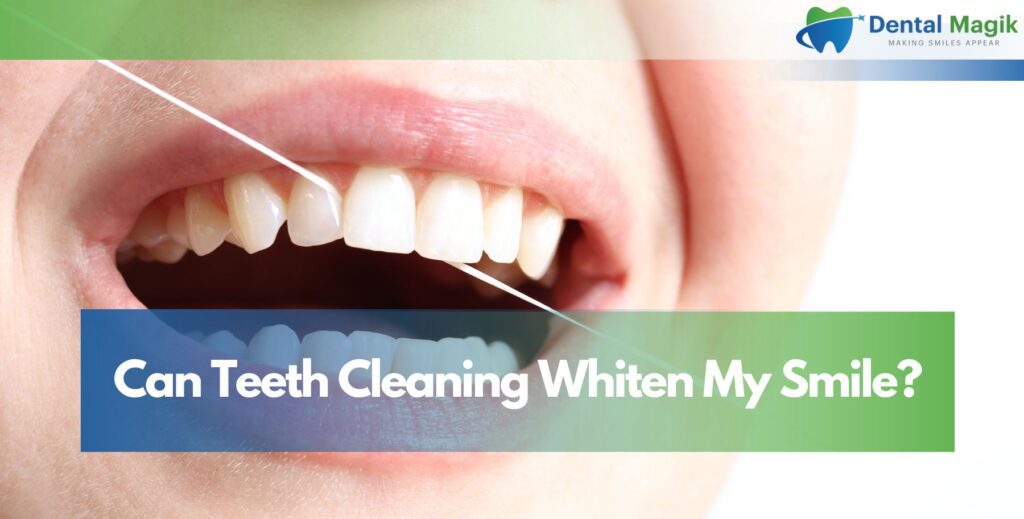Can Teeth Cleaning Whiten My Smile?