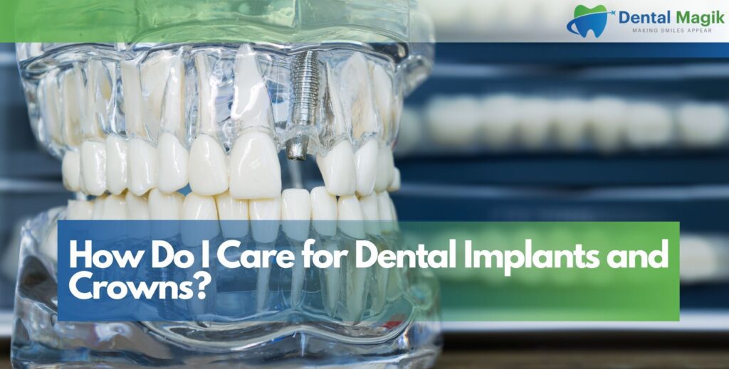 How Do I Care for Dental Implants and Crowns?