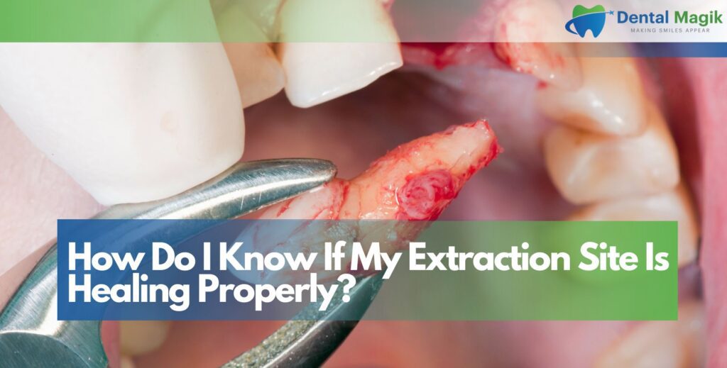 How Do I Know If My Extraction Site Is Healing Properly?