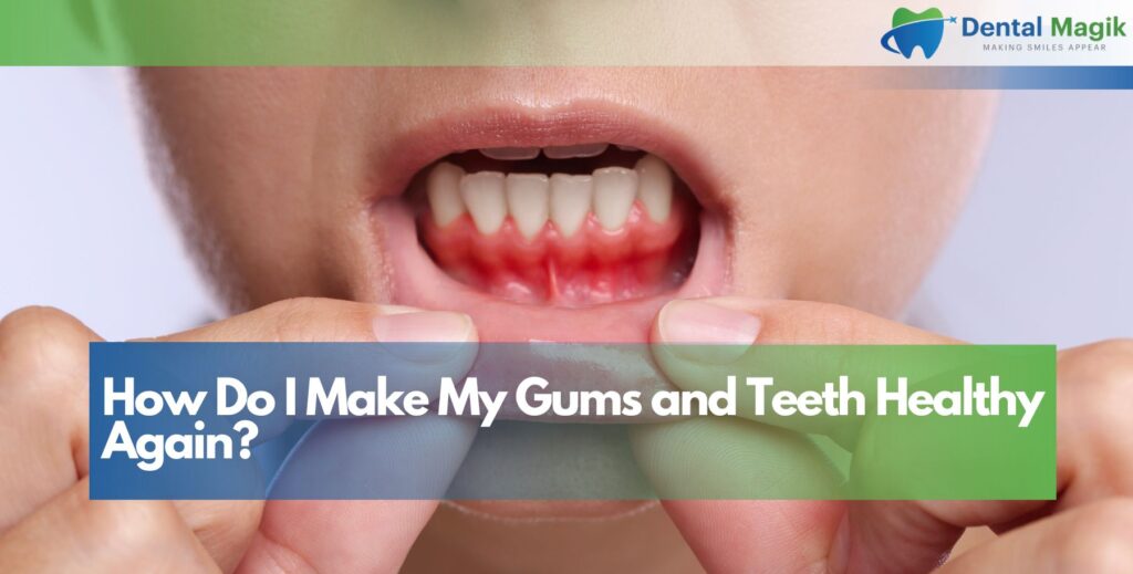 How Do I Make My Gums and Teeth Healthy Again?
