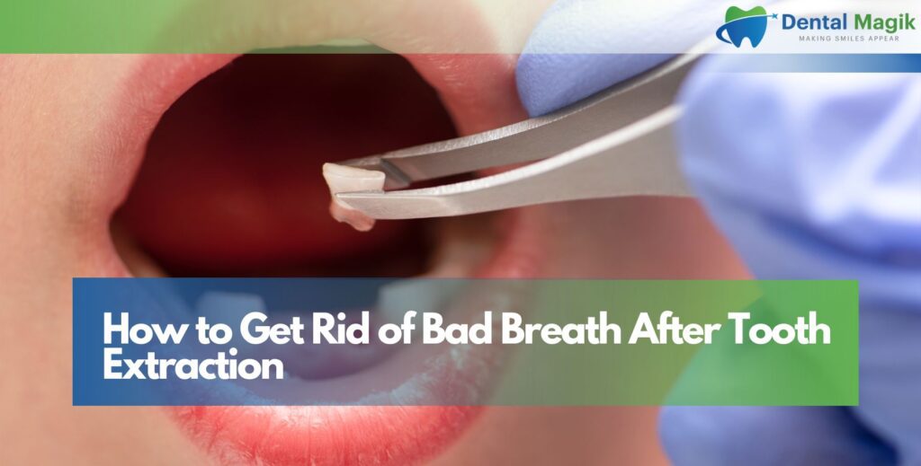 How to Get Rid of Bad Breath After Tooth Extraction