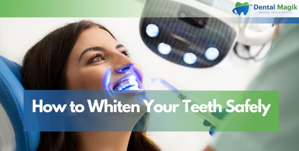 How to Whiten Your Teeth Safely