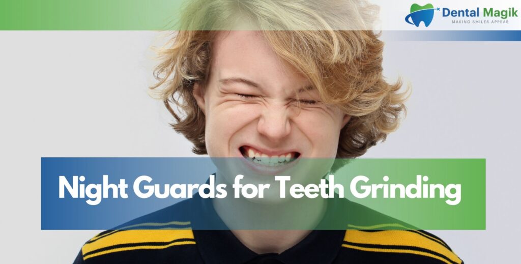Night Guards for Teeth Grinding