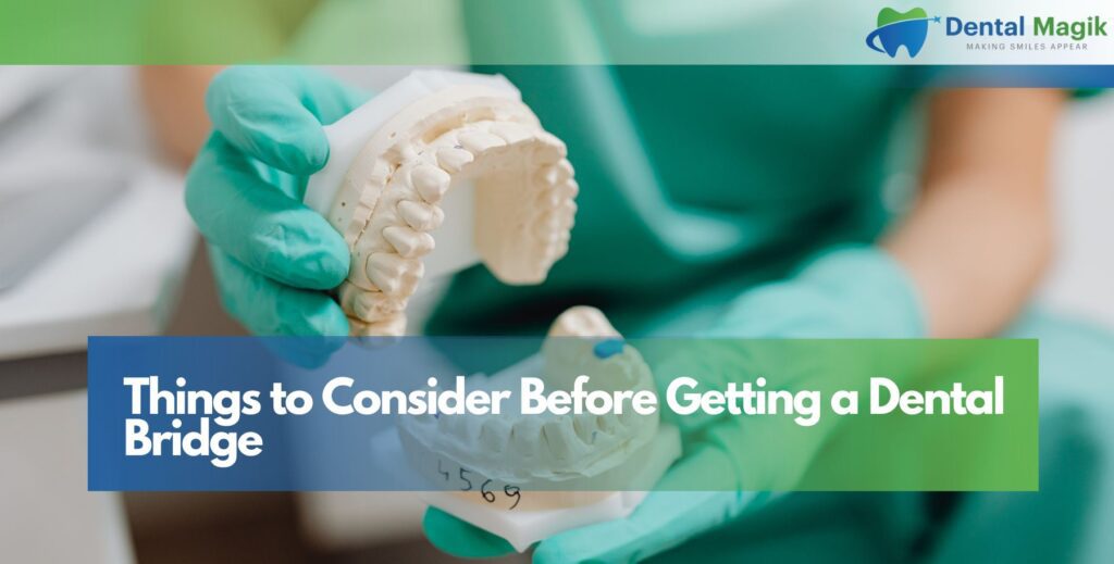 Things to Consider Before Getting a Dental Bridge