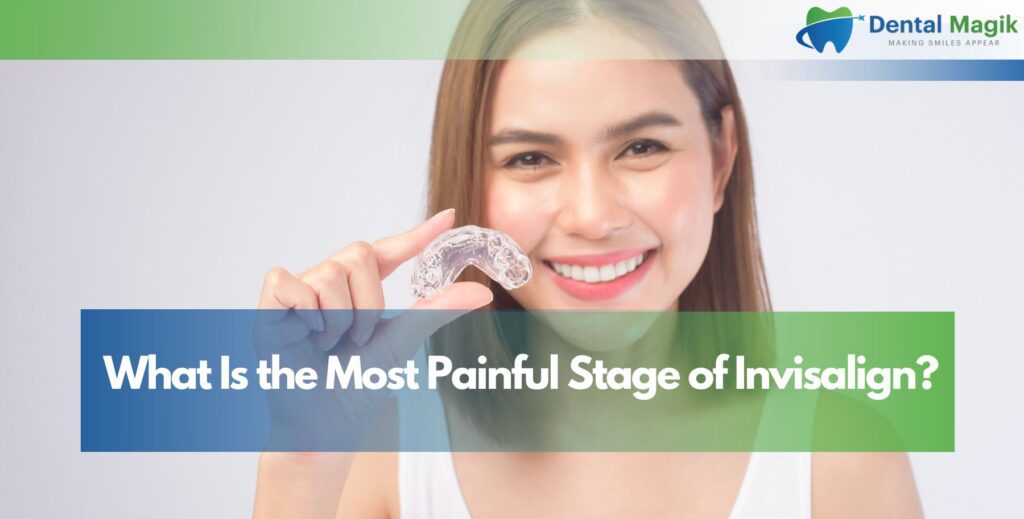 What Is the Most Painful Stage of Invisalign?