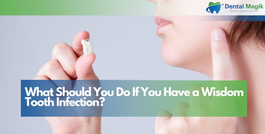 What Should You Do If You Have a Wisdom Tooth Infection?