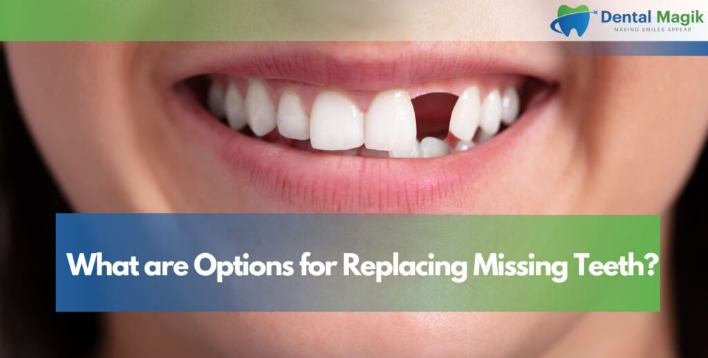 What are Options for Replacing Missing Teeth?