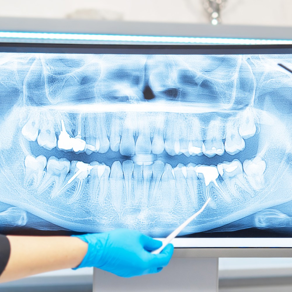 Patient reviewing dental images on screen with dentist