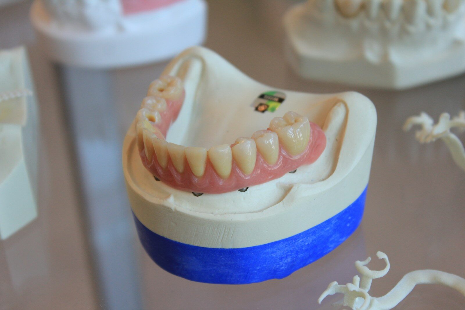 Photo by Diana Polekhina dentures on white scale rack