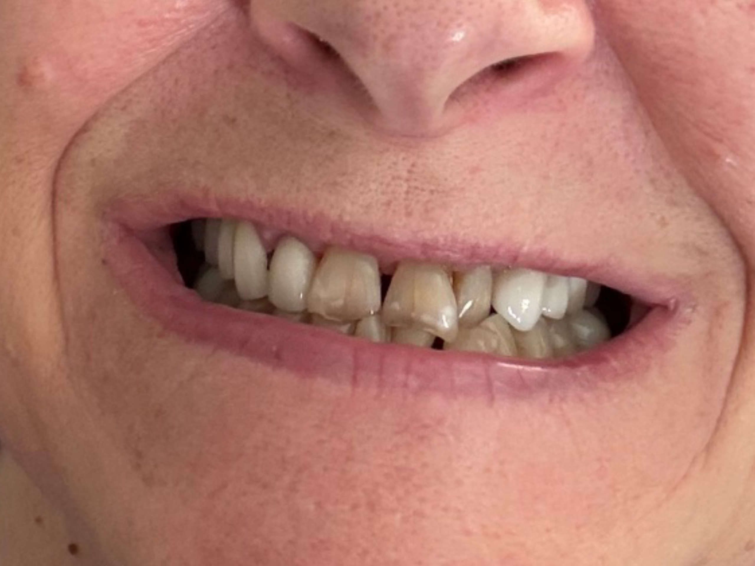 Patient smile after dental treatment at Dental Magik