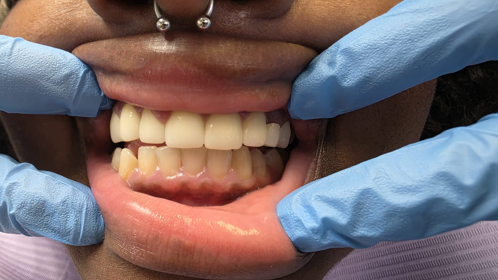 After dental treatment at Dental Magik