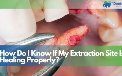 How Do I Know If My Extraction Site Is Healing Properly?